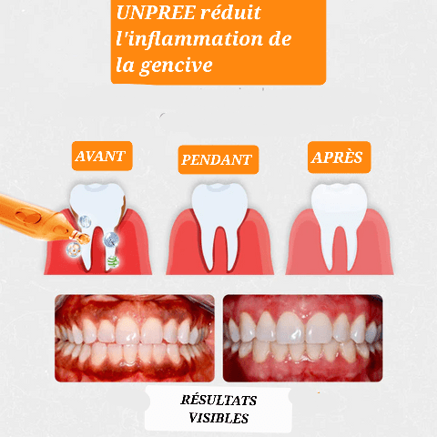 AMPOULES DE RÉPARATION GENCIVES UNPREE™ - Hodamart