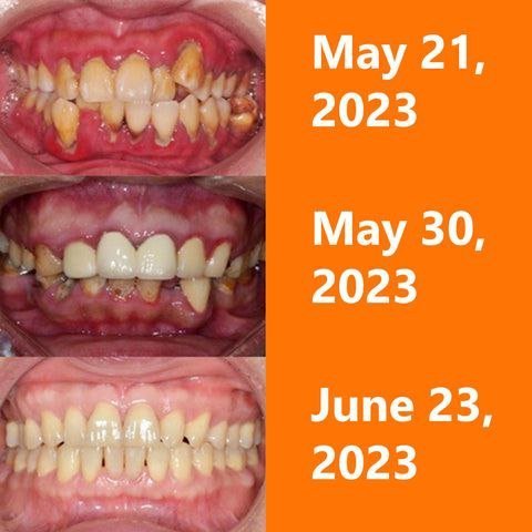 AMPOULES DE RÉPARATION GENCIVES UNPREE™ - Hodamart