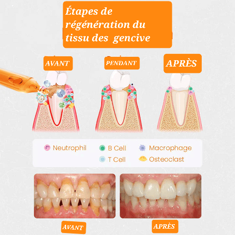 AMPOULES DE RÉPARATION GENCIVES UNPREE™ - Hodamart