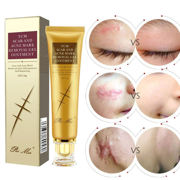 Crème anti - cicatrices, soins pour la peau, traitement des vergetures, boutons, taches - Hodamart