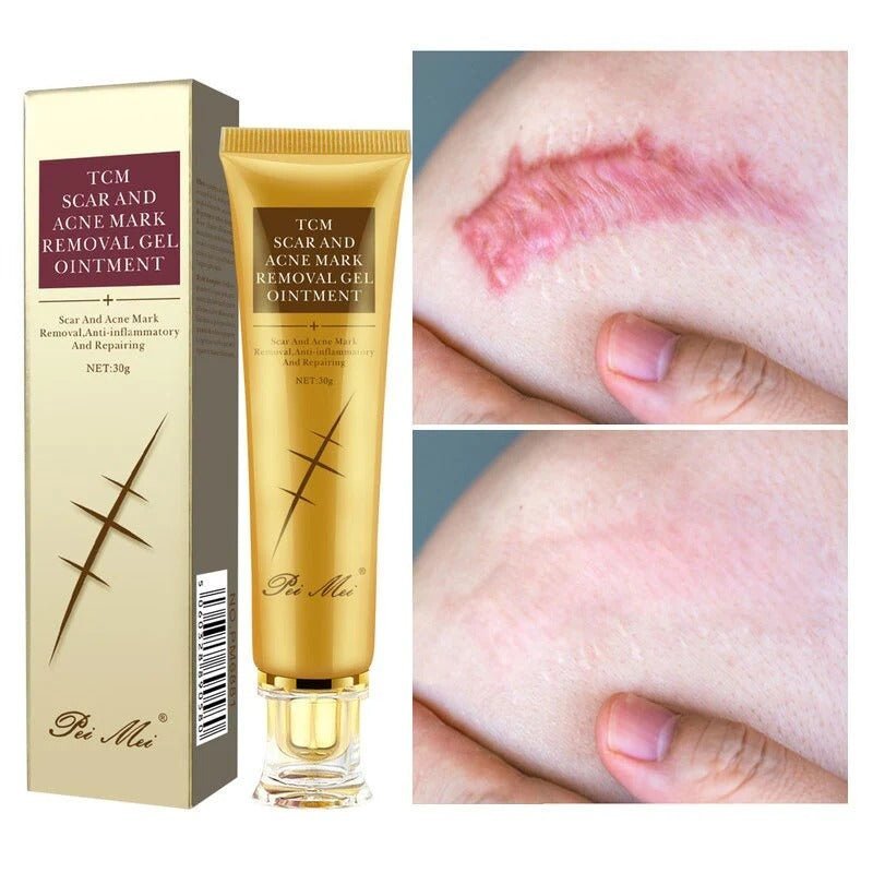 Crème anti - cicatrices, soins pour la peau, traitement des vergetures, boutons, taches - Hodamart