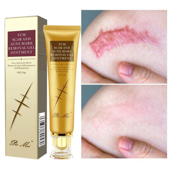 Crème anti - cicatrices, soins pour la peau, traitement des vergetures, boutons, taches - Hodamart