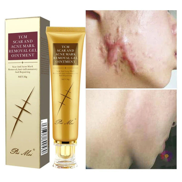 Crème anti - cicatrices, soins pour la peau, traitement des vergetures, boutons, taches - Hodamart