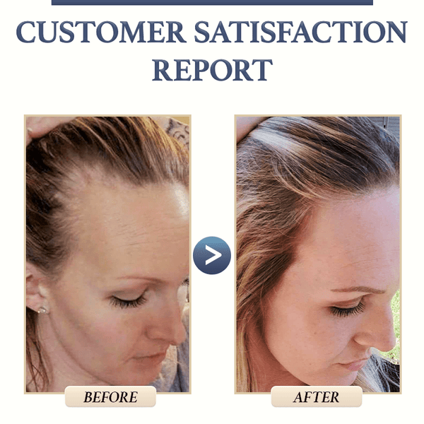 OriginGROWTH™ - Le Shampooing solide anti - chute de cheveux - Hodamart