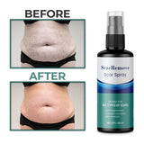 Scar Removal Spray 50ml - Hodamart