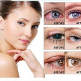 ULTRAEYE™ - Votre Solution Naturelle pour les Problèmes Oculaires - Hodamart