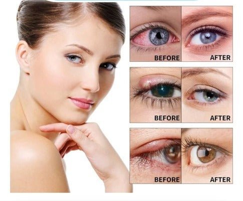 ULTRAEYE™ - Votre Solution Naturelle pour les Problèmes Oculaires - Hodamart