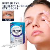 ULTRAEYE™ - Votre Solution Naturelle pour les Problèmes Oculaires - Hodamart