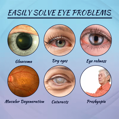 ULTRAEYE™ - Votre Solution Naturelle pour les Problèmes Oculaires - Hodamart