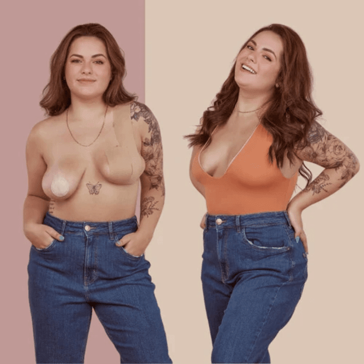 UP Bande - vous n'avez plus besoin de porter de soutien - gorge - Hodamart